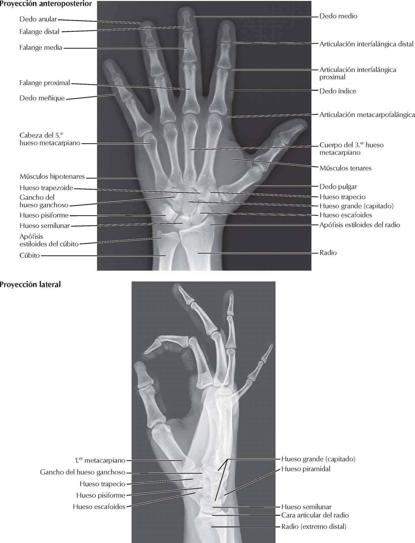 Carpo y mano: radiografías