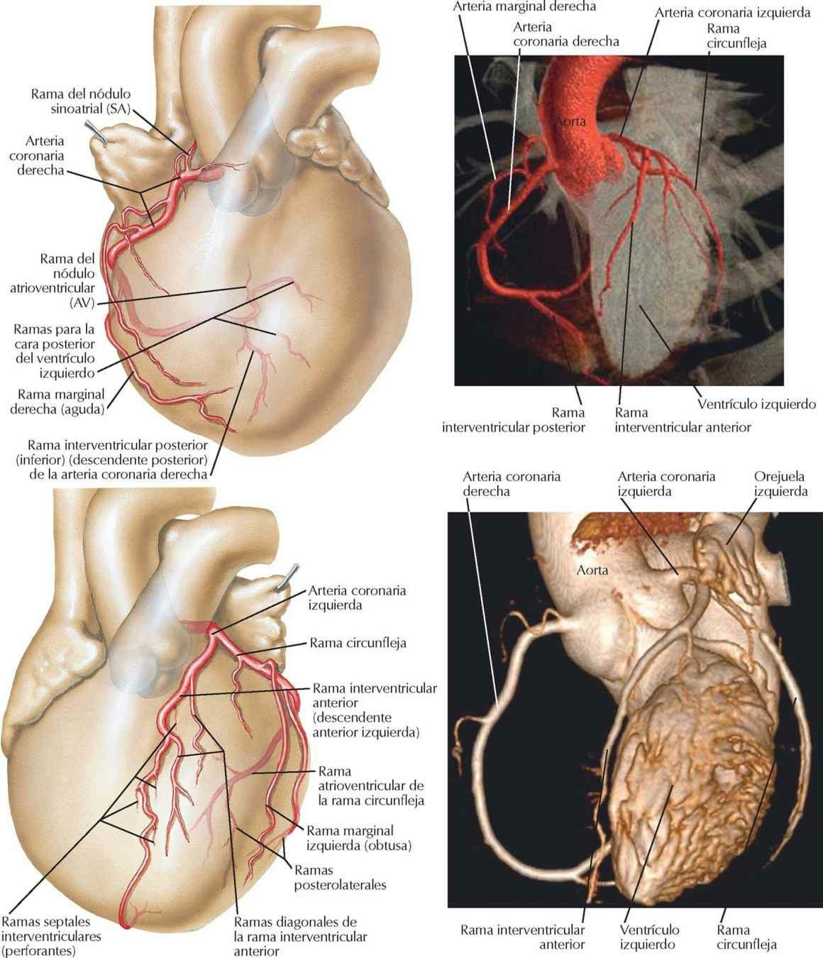 Arterias coronarias: visiones anteriores, TC y 3D