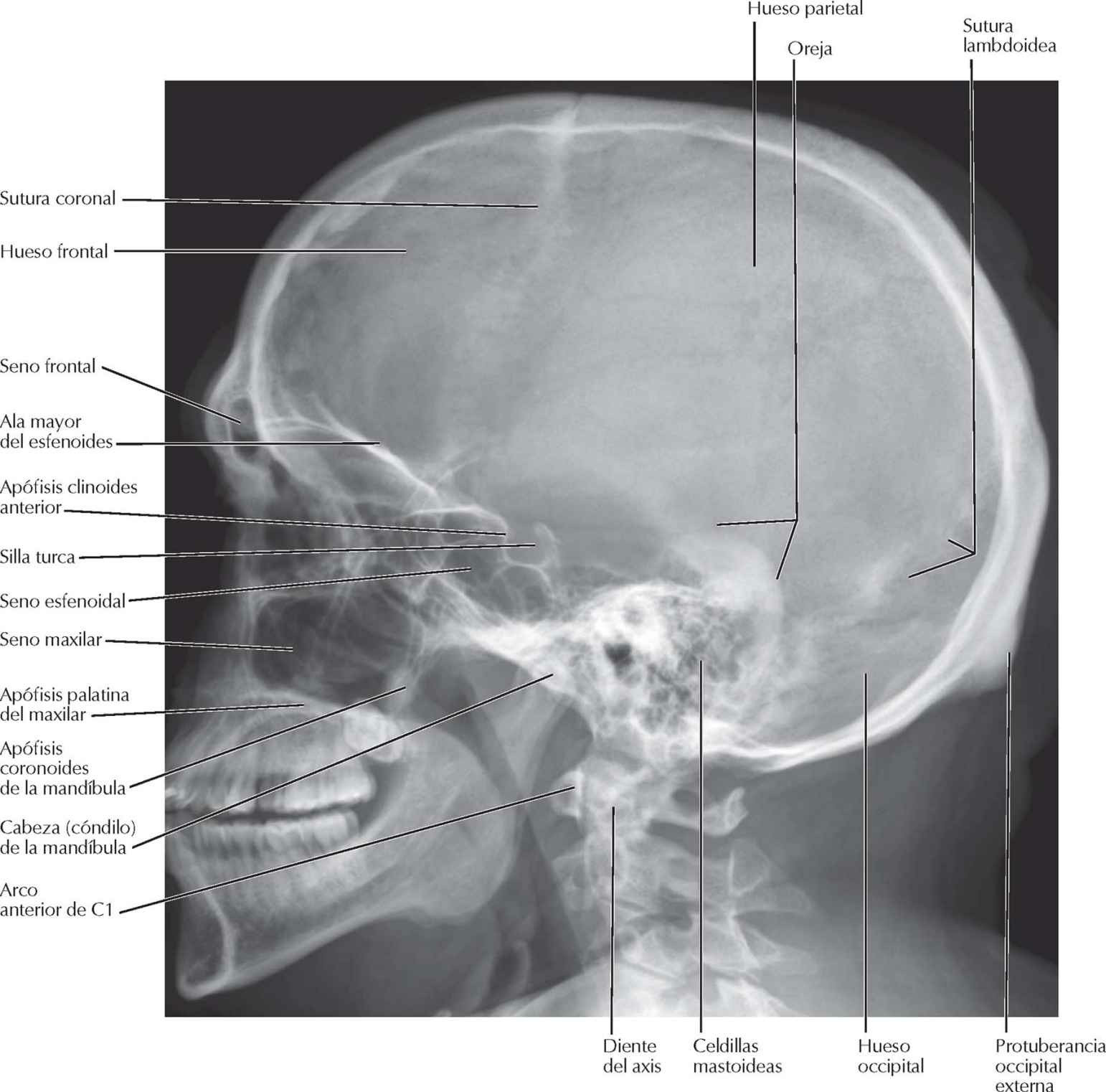 Cráneo: radiografía lateral.