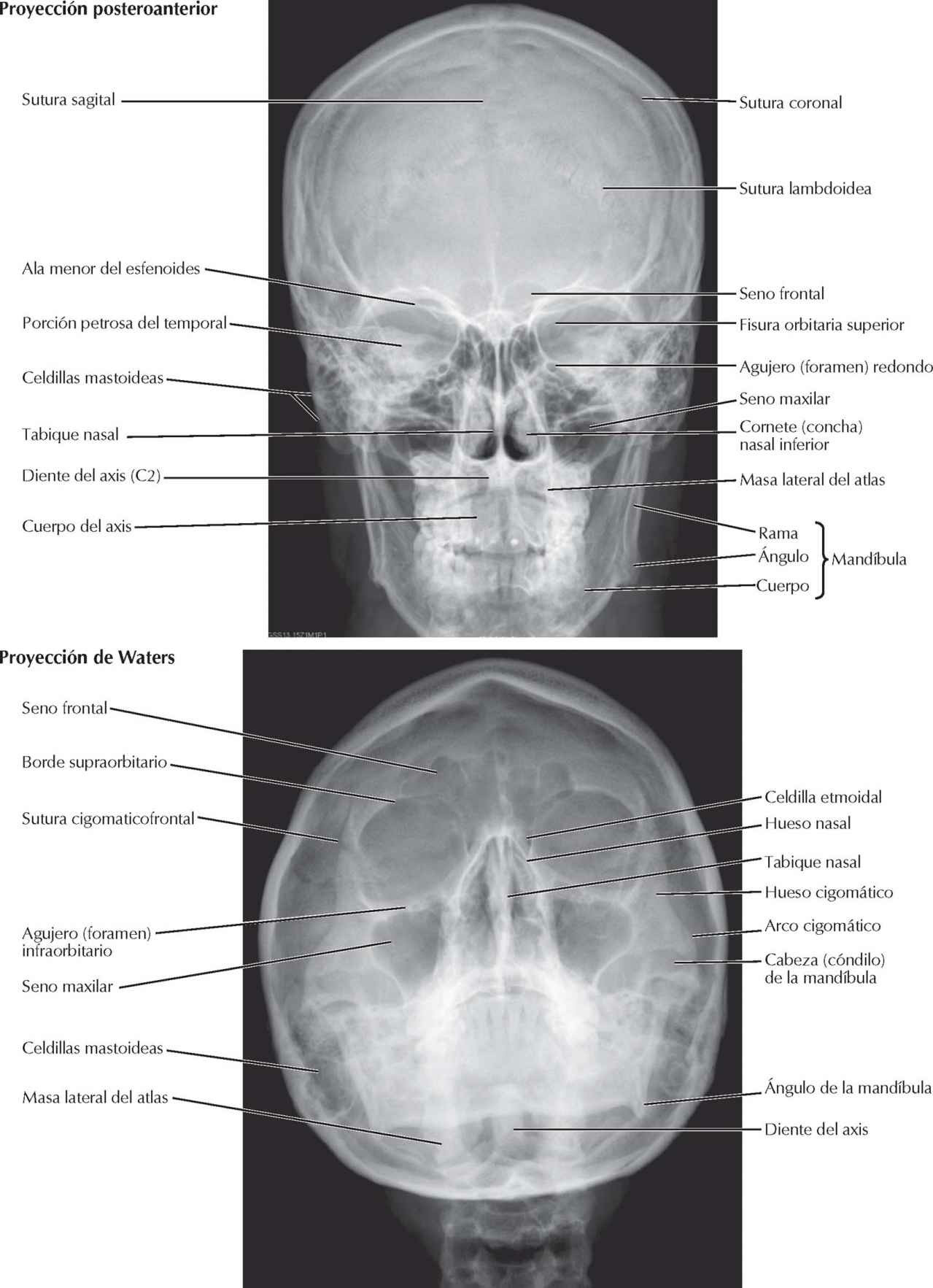 Cráneo: radiografías.