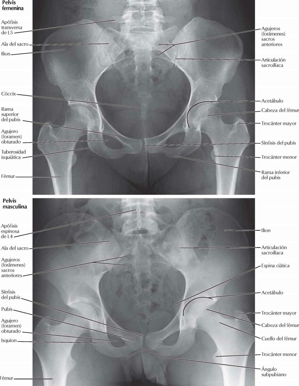 Radiografías de la pelvis: femenina y masculina