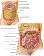 Cavidad Peritoneal